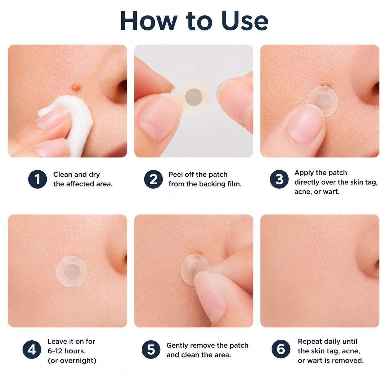 🔥DarkFairy 2-in-1 Microneedle & Hydrocolloid Patch🍀| Removes Raised Moles, Acne, Flat Warts & Skin Tags | Helps Improve Wrinkles, Scars & Blemishes | Invisible Patches for Face & Body