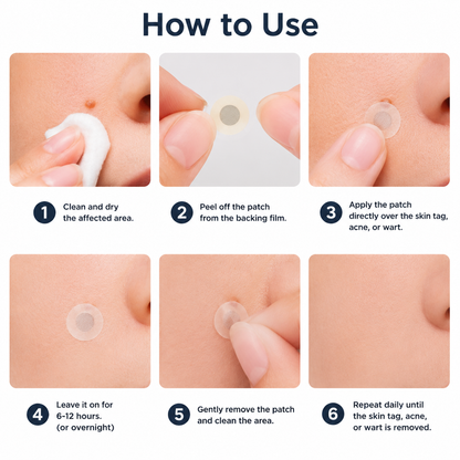 🔥DarkFairy 2-in-1 Microneedle & Hydrocolloid Patch🍀| Removes Raised Moles, Acne, Flat Warts & Skin Tags | Helps Improve Wrinkles, Scars & Blemishes | Invisible Patches for Face & Body