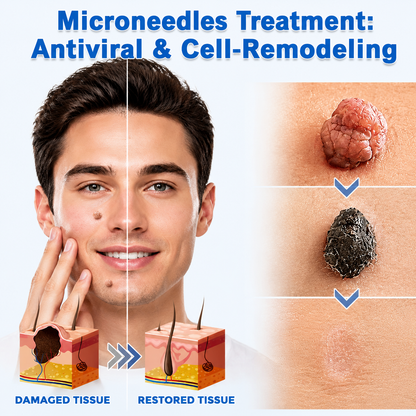 🔥DarkFairy 2-in-1 Microneedle & Hydrocolloid Patch🍀| Removes Raised Moles, Acne, Flat Warts & Skin Tags | Helps Improve Wrinkles, Scars & Blemishes | Invisible Patches for Face & Body